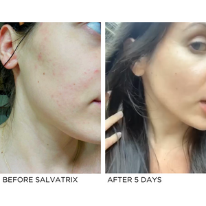 Salvatrix | Anti-Blemish Serum